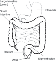 Inflammatory Bowel Disease colon uc(1)